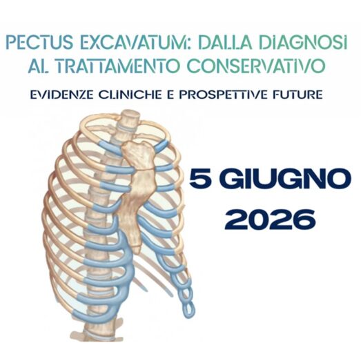 PECTUS EXCAVATUM: dalla diagnosi al trattamento conservativo. Evidenze cliniche e prospettive future.